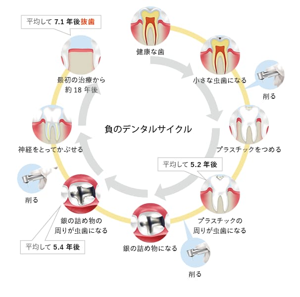 負のデンタルサイクル