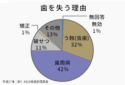 歯を失う原因の第一位は「歯周病」