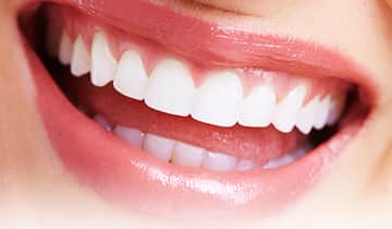 補綴前処置としての歯周形成外科治療